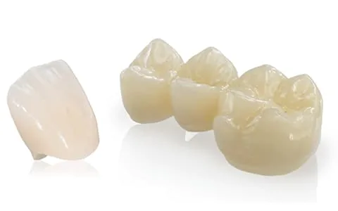 セラミック歯