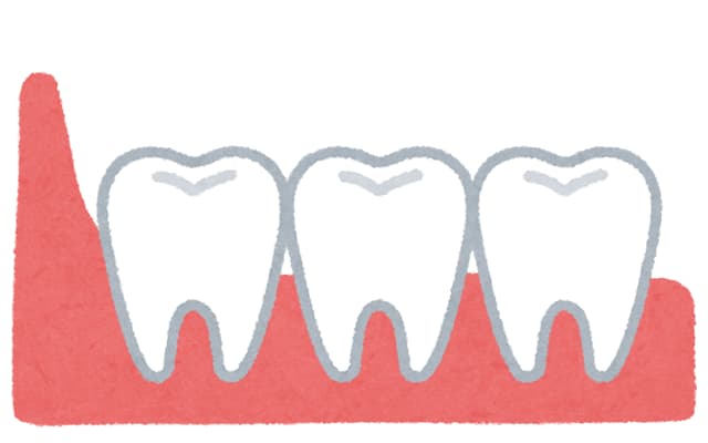 親知らずの処置 芝浦アイランド歯科